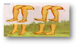34594_mdbm_2466.png